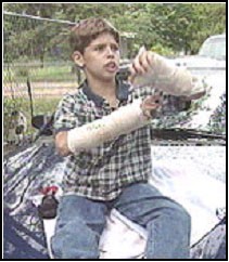 This nine-year-old Montgomery County, Texas boy was playing in his yard when he was suddenly attacked by a neighbor's 'pet' macaque monkey.